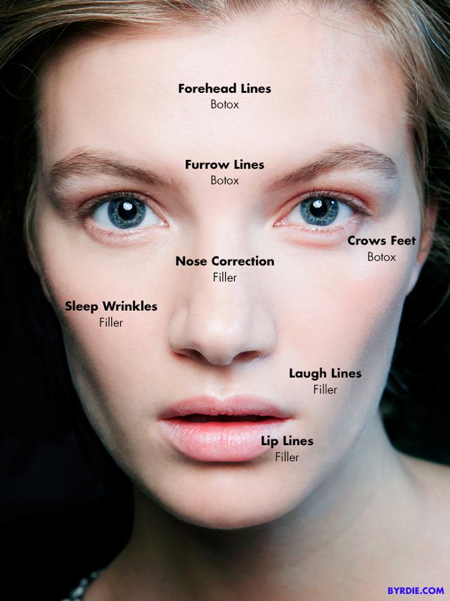 botox-vs-filler