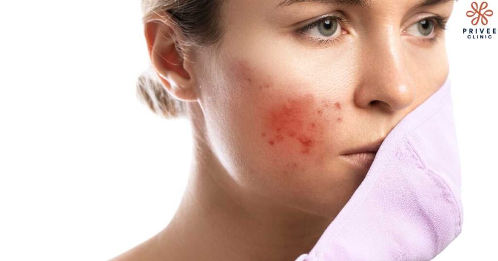 Ciri-Ciri Kulit Wajah yang Tidak Cocok dengan Skincare - Privee Clinic