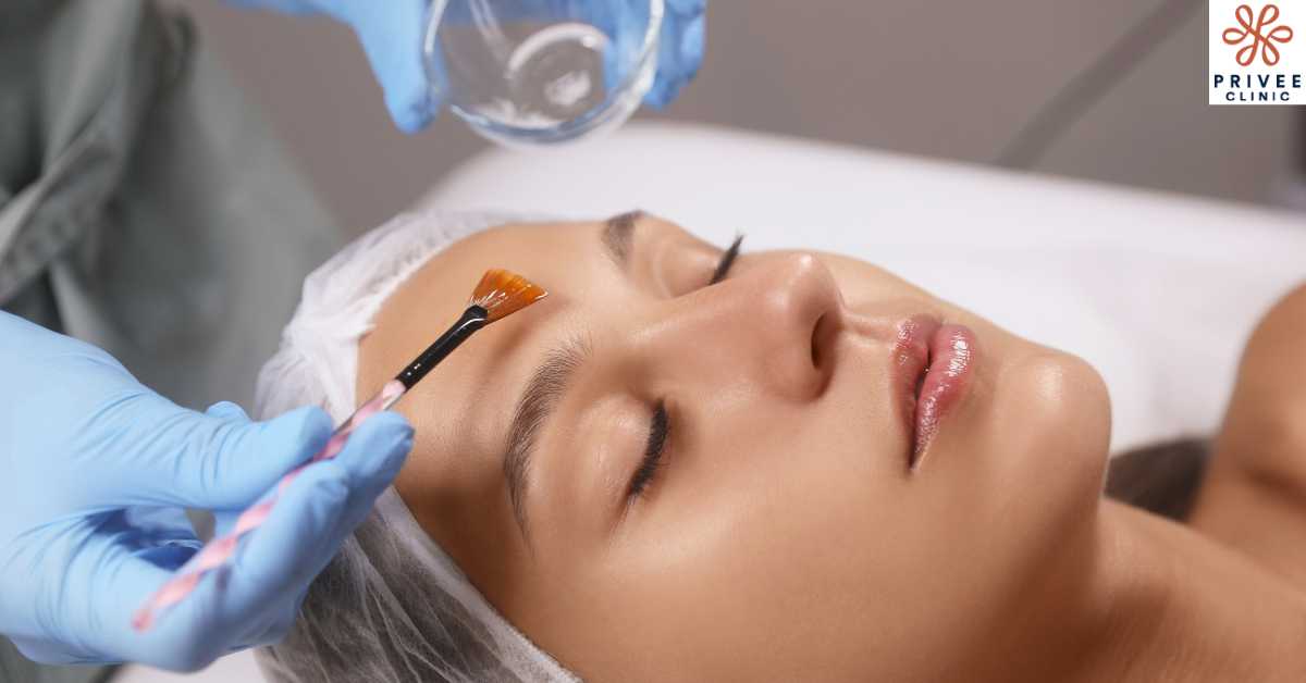 Jenis Peeling yang Bagus untuk Flek Hitam - Privee Clinic