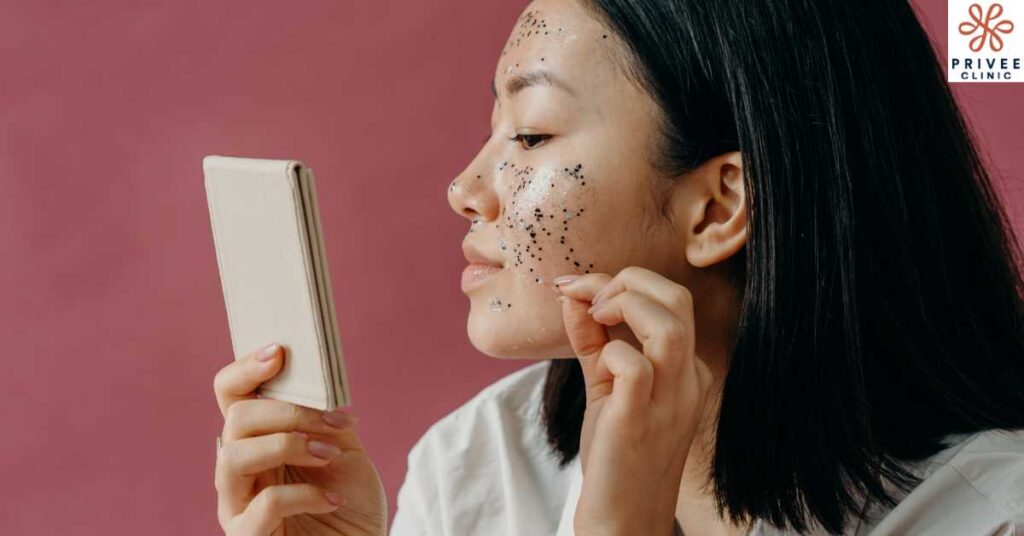 Peeling Wajah Kulit Cerah & Halus dengan Eksfoliasi Kimia