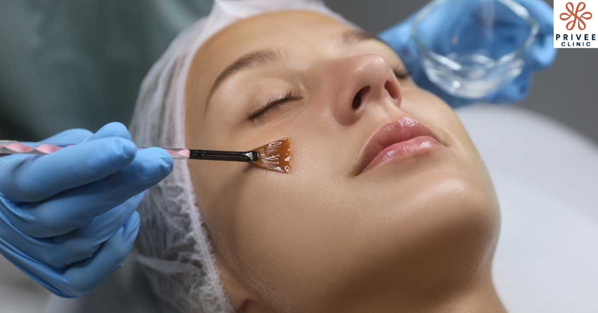 Prosedur Peeling Wajah di Klinik - Privee Clinic