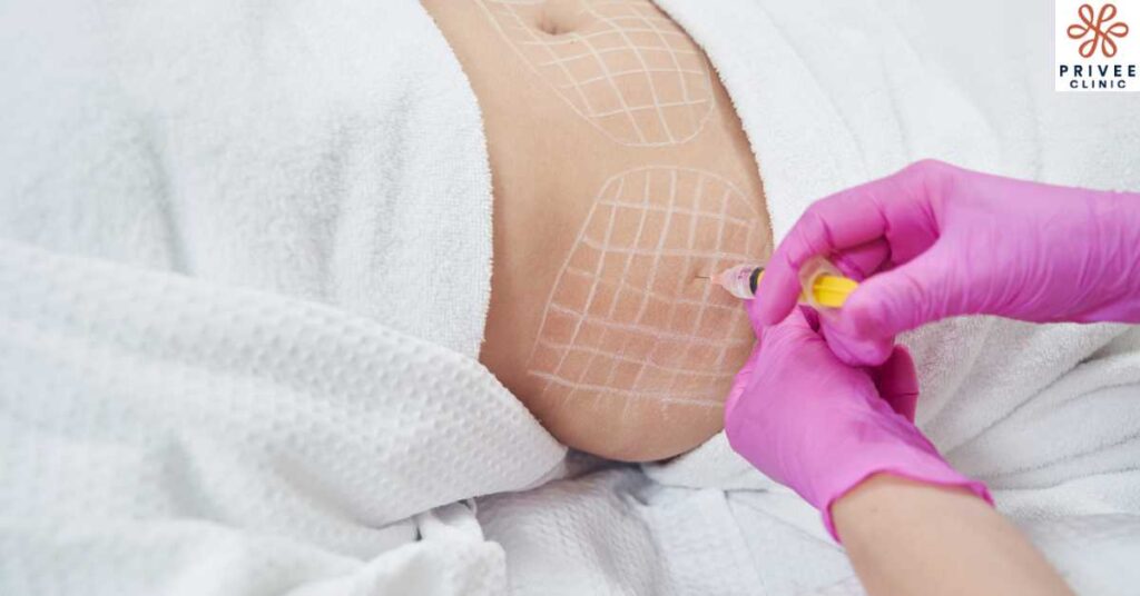 Fat Dissolving Injections Bye Bye Sel Lemak! - Privee Clinic