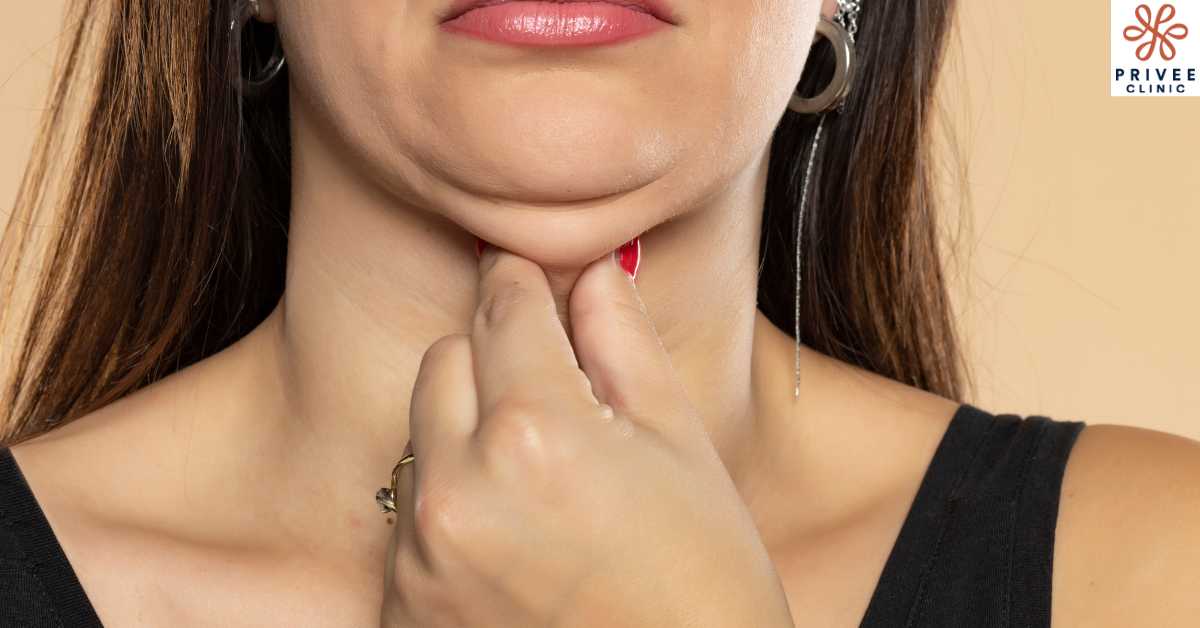 Kenapa Bisa Ada Double Chin - Privee Clinic