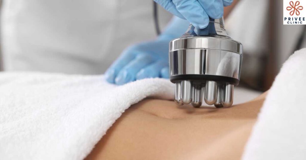 Onda Pro vs RF Mana Lebih Efektif Hilangkan Lemak - Privee Clinic