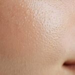 chicken skin Privee Clinic