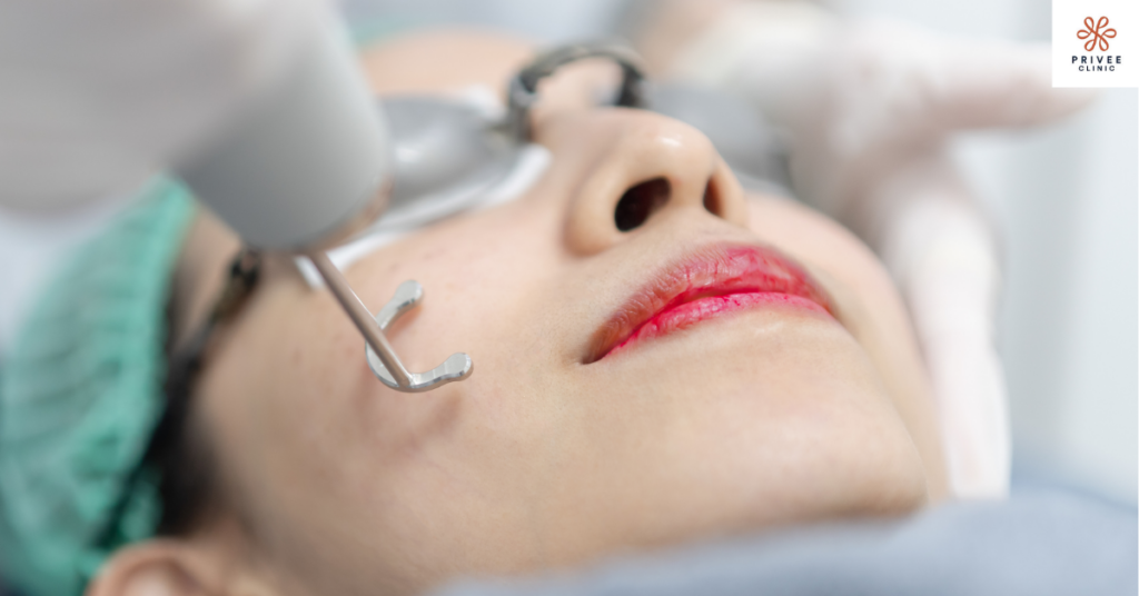 pico laser privee clinic